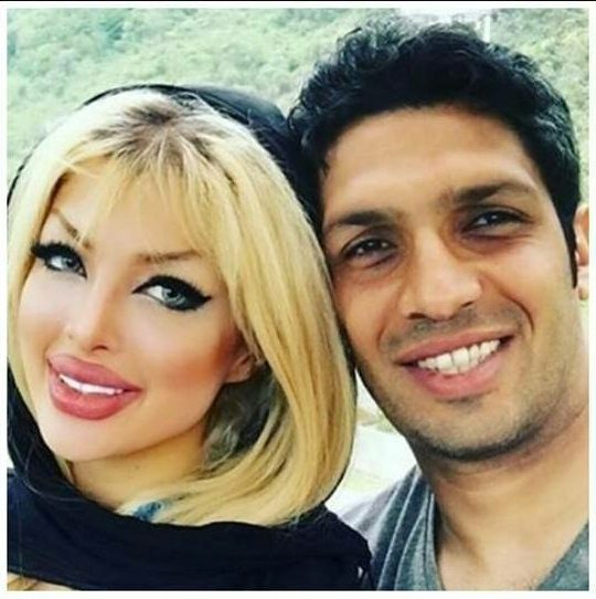 عکس همسر سپهر حیدری قبل عمل
